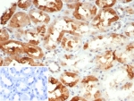 IHC staining of FFPE human kidney tissue with Crystallin Alpha B antibody (clone CRYAB/4665). Inset: PBS used in place of primary Ab (secondary Ab negative control). HIER: boil tissue sections in pH 9 10mM Tris with 1mM EDTA for 20 min and allow to cool before testing.