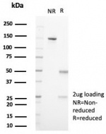 SDS-PAGE analysis of purified, BSA-free WT1 antibody (clone WT1/7715) as confirmation of integrity and purity.