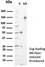 SDS-PAGE analysis of purified, BSA-free FSH beta antibody (clone FSHB/6845) as confirmation of integrity and purity.