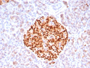 PAX6 Antibody Pancreatic Islet IHC. Immunohistochemistry analysis of Paired box protein Pax-6 (PAX6) in formalin-fixed, paraffin-embedded human pancreas tissue using PAX6 antibody clone PAX6/8578R. Strong nuclear HRP-DAB brown staining highlights endocrine cells within pancreatic islets, while surrounding exocrine tissue shows minimal signal, consistent with known PAX6 expression patterns. HIER: boil tissue sections in pH 9 10 mM Tris with 1 mM EDTA for 20 min followed by cooling before testing.