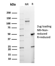 PAX6 Antibody SDS-PAGE (Reducing vs Non-Reducing). SDS-PAGE analysis of PAX6 antibody clone PAX6/8578R under reducing (R) and non-reducing (NR) conditions. Bands corresponding to antibody heavy and light chains are observed under reducing conditions, consistent with expected antibody structure.