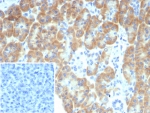 IHC staining of FFPE human pancreas tissue with TRPC6 antibody (clone TRPC6/7671). Inset: PBS used in place of primary Ab (secondary Ab negative control). HIER: boil tissue sections in pH 9 10mM Tris with 1mM EDTA for 20 min and allow to cool before testing.