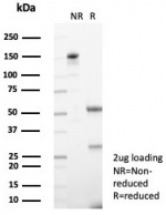 SDS-PAGE analysis of purified, BSA-free TRPC6 antibody (clone TRPC6/7672) as confirmation of integrity and purity.