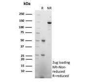 SDS-PAGE analysis of purified, BSA-free p57 antibody (clone KIP2/7187) as confirmation of integrity and purity.