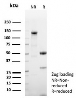 SDS-PAGE analysis of purified, BSA-free p57 antibody (clone KIP2/8572) as confirmation of integrity and purity.