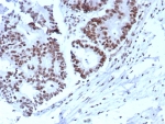 IHC staining of FFPE human colon. Strong nuclear staining using KIP2/8572 at 2ug/ml. HIER: boil tissue sections in pH 9 10mM Tris with 1mM EDTA for 20 min and allow to cool before testing.