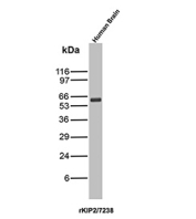 p57Kip2 Antibody Human Brain WB. Western blot analysis of p57Kip2 / CDKN1C expression in human brain tissue lysate using p57Kip2 antibody clone rKIP2/7238. Lane 1: human brain lysate. A band is detected at approximately 55-60 kDa, consistent with the predicted molecular weight of p57Kip2 (CDKN1C), a cyclin-dependent kinase inhibitor that regulates cell cycle progression and differentiation. The clear detection in brain tissue supports the use of this clone for western blot analysis of neural samples.