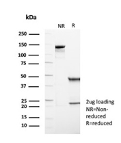 SDS-PAGE analysis of purified, BSA-free p57Kip2 antibody (rKIP2/7238) as confirmation of integrity and purity.