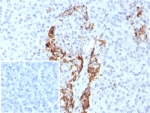IHC staining of FFPE human pancreas tissue with Insulin antibody (clone rIRDN/8546). Inset: PBS used in place of primary Ab (secondary Ab negative control). HIER: boil tissue sections in pH 9 10mM Tris with 1mM EDTA for 20 min and allow to cool before testing.