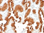 IHC staining of FFPE human stomach tissue with MUC5AC antibody (clone rMUC5AC/8052) at 2ug/ml. HIER: boil tissue sections in pH 9 10mM Tris with 1mM EDTA for 20 min and allow to cool before testing.
