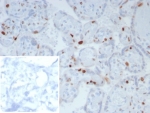 IHC staining of FFPE human placental tissue with p57Kip2 antibody; Inset: PBS used in place of primary Ab (secondary Ab negative control). HIER: boil tissue sections in pH 9 10mM Tris with 1mM EDTA for 20 min and allow to cool before testing.