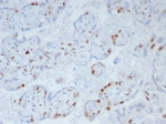 IHC staining of FFPE human placenta. Strong nuclear staining using KIP2/8169R at 2ug/ml. HIER: boil tissue sections in pH 9 10mM Tris with 1mM EDTA for 20 min and allow to cool before testing.