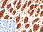 IHC staining of FFPE human stomach tissue with MUC5AC antibody (clone MUC5AC/7798R). Inset: PBS used in place of primary Ab (secondary Ab negative control). HIER: boil tissue sections in pH 9 10mM Tris with 1mM EDTA for 20 min and allow to cool before testing.