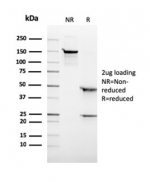 SDS-PAGE analysis of purified, BSA-free CD6 antibody (clone rC6/372) as confirmation of integrity and purity.