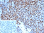 IHC staining of FFPE human tonsil tissue with CD6 antibody (clone rC6/372). Inset: PBS used in place of primary Ab (secondary Ab negative control). HIER: boil tissue sections in pH 9 10mM Tris with 1mM EDTA for 20 min and allow to cool before testing.