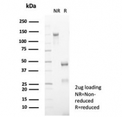 SDS-PAGE analysis of purified, BSA-free CD5 antibody (clone rC5/6976) as confirmation of integrity and purity.