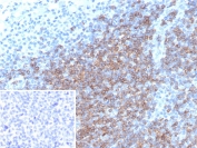 IHC staining of FFPE human tonsil tissue with CD5 antibody (clone rC5/6976). Inset: PBS used in place of primary Ab (secondary Ab negative control). HIER: boil tissue sections in pH 9 10mM Tris with 1mM EDTA for 20 min and allow to cool before testing.