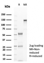 SDS-PAGE analysis of purified, BSA-free CD20 antibody (clone rMS4A1/8044) as confirmation of integrity and purity.