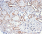 IHC staining of FFPE human kidney tissue with CD20 antibody (clone MS4A1/6993R). HIER: boil tissue sections in pH 9 10mM Tris with 1mM EDTA for 20 min and allow to cool before testing.