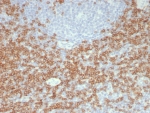 IHC staining of FFPE human tonsil tissue with recombinant CD5 antibody (clone C5/8117R). HIER: boil tissue sections in pH 9 10mM Tris with 1mM EDTA for 20 min and allow to cool before testing.