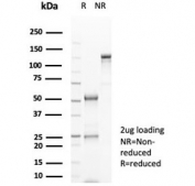 SDS-PAGE analysis of purified, BSA-free recombinant CD20 antibody (clone MS4A1/8072R) as confirmation of integrity and purity.