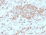 IHC staining of FFPE human breast tissue with DRAP1 antibody (clone PCRP-DRAP1-1A8) HIER: boil tissue sections in pH 9 10mM Tris with 1mM EDTA for 20 min and allow to cool before testing.