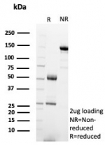 SDS-PAGE analysis of purified, BSA-free BOB1 antibody (clone BOB1/7467) as confirmation of integrity and purity.