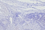 Negative control: IHC testing of FFPE human skin in tonsil with BOB1 antibody (clone BOB1/7469) at 2ug/ml. HIER: boil tissue sections in pH 9 10mM Tris with 1mM EDTA for 20 min and allow to cool before testing.