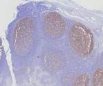 IHC staining of FFPE human tonsil tissue with BOB1 antibody (clone BOB1/7469). HIER: boil tissue sections in pH 9 10mM Tris with 1mM EDTA for 20 min and allow to cool before testing.