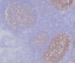IHC staining of FFPE human tonsil tissue with BOB1 antibody (clone BOB1/7469). HIER: boil tissue sections in pH 9 10mM Tris with 1mM EDTA for 20 min and allow to cool before testing.