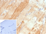 IHC staining of FFPE human skeletal muscle tissue with Crystallin Alpha B antibody (clone CRYAB/4661). Inset: PBS used in place of primary Ab (secondary Ab negative control). HIER: boil tissue sections in pH 9 10mM Tris with 1mM EDTA for 20 min and allow to cool before testing.