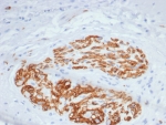 IHC staining of FFPE human colon tissue with CD56 antibody (clone NCAM/7520). HIER: boil tissue sections in pH 9 10mM Tris with 1mM EDTA for 20 min and allow to cool before testing.