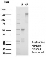 SDS-PAGE analysis of purified, BSA-free CD56 antibody (clone NCAM/7520) as confirmation of integrity and purity.