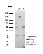 SDS-PAGE analysis of purified, BSA-free Crystallin Alpha B antibody (clone CRYAB/7917) as confirmation of integrity and purity.