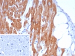 IHC staining of FFPE human heart tissue with Crystallin Alpha B antibody (clone CRYAB/7917). Inset: PBS used in place of primary Ab (secondary Ab negative control). HIER: boil tissue sections in pH 9 10mM Tris with 1mM EDTA for 20 min and allow to cool before testing.