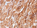 IHC staining of FFPE human heart tissue with Crystallin Alpha B antibody (clone CRYAB/7918). HIER: boil tissue sections in pH 9 10mM Tris with 1mM EDTA for 20 min and allow to cool before testing.