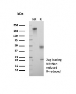 SDS-PAGE analysis of purified, BSA-free Crystallin Alpha B antibody (clone CRYAB/7918) as confirmation of integrity and purity.