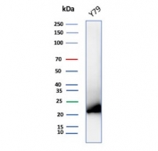 Western blot testing of human Y79 cell lysate with Crystallin Alpha B antibody (clone CRYAB/7918).