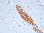 IHC staining of FFPE human colon tissue with CD56 antibody (clone NCAM/7523). HIER: boil tissue sections in pH 9 10mM Tris with 1mM EDTA for 20 min and allow to cool before testing.