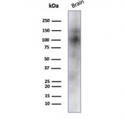 Western blot testing of human brain tissue lysate with CD56 antibody (clone NCAM/7523). Predicted molecular weight: ~110 kDa (soluble fragment), ~120/125 kDa (GPI-anchored), 140/180 kDa (transmembrane isoforms).
