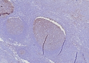 IHC staining of FFPE human tonsil tissue with BOB1 antibody (clone BOB1/7468). HIER: boil tissue sections in pH 9 10mM Tris with 1mM EDTA for 20 min and allow to cool before testing.