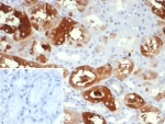 IHC staining of FFPE human kidney tissue with Crystallin Alpha B antibody (clone CRYAB/4666). Inset: PBS used in place of primary Ab (secondary Ab negative control). HIER: boil tissue sections in pH 9 10mM Tris with 1mM EDTA for 20 min and allow to cool before testing.