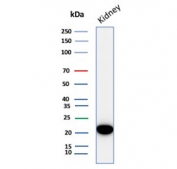 Western blot testing of human kidney tissue lysate with Crystallin Alpha B antibody (clone CRYAB/4666). Predicted molecular weight ~20 kDa.