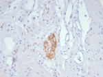 IHC staining of FFPE human colon tissue with CD56 antibody (clone NCAM/7521). HIER: boil tissue sections in pH 9 10mM Tris with 1mM EDTA for 20 min and allow to cool before testing.