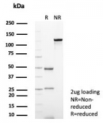 SDS-PAGE analysis of purified, BSA-free CD56 antibody (clone NCAM/7522) as confirmation of integrity and purity.