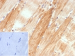 IHC staining of FFPE human skeletal muscle tissue with Crystallin Alpha B antibody (clone CRYAB/4662). Inset: PBS used in place of primary Ab (secondary Ab negative control). HIER: boil tissue sections in pH 9 10mM Tris with 1mM EDTA for 20 min and allow to cool before testing.