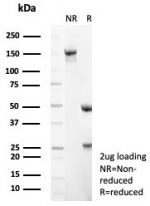 SDS-PAGE analysis of purified, BSA-free recombinant CD56 antibody (clone NCAM1/8392R) as confirmation of integrity and purity.