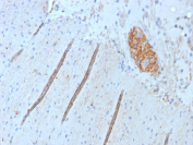 NCAM CD56 Antibody (clone NCAM1/9074R). Immunohistochemistry of FFPE human colon tissue demonstrates membranous and cytoplasmic staining in scattered neural and neuroendocrine-associated structures consistent with expression of Neural cell adhesion molecule 1 (NCAM1), also known as CD56. Brown chromogenic signal highlights NCAM1-positive cells within nerve fibers and localized cell clusters embedded in the surrounding stromal tissue, while most epithelial and stromal cells show minimal staining. Heat-induced epitope retrieval was performed by boiling tissue sections in pH 9 10mM Tris with 1mM EDTA for 20 minutes followed by cooling prior to antibody incubation.