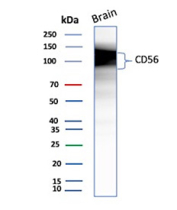 NCAM Antibody for WB (clone NCAM1/9074R). Western blot analysis of human brain tissue lysate demonstrates a strong band cluster between approximately 120-180 kDa corresponding to Neural cell adhesion molecule 1 (NCAM1), also known as CD56. The observed band pattern reflects the major NCAM isoforms and glycosylated forms commonly detected in neural tissues. High expression of NCAM1 in brain lysate is consistent with the well-established role of CD56 in neuronal development, synaptic plasticity, and neural cell adhesion.