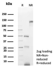 SDS-PAGE Analysis of Purified NCAM CD56 Antibody (NCAM1/9074R). Confirmation of Purity and Integrity of Antibody.